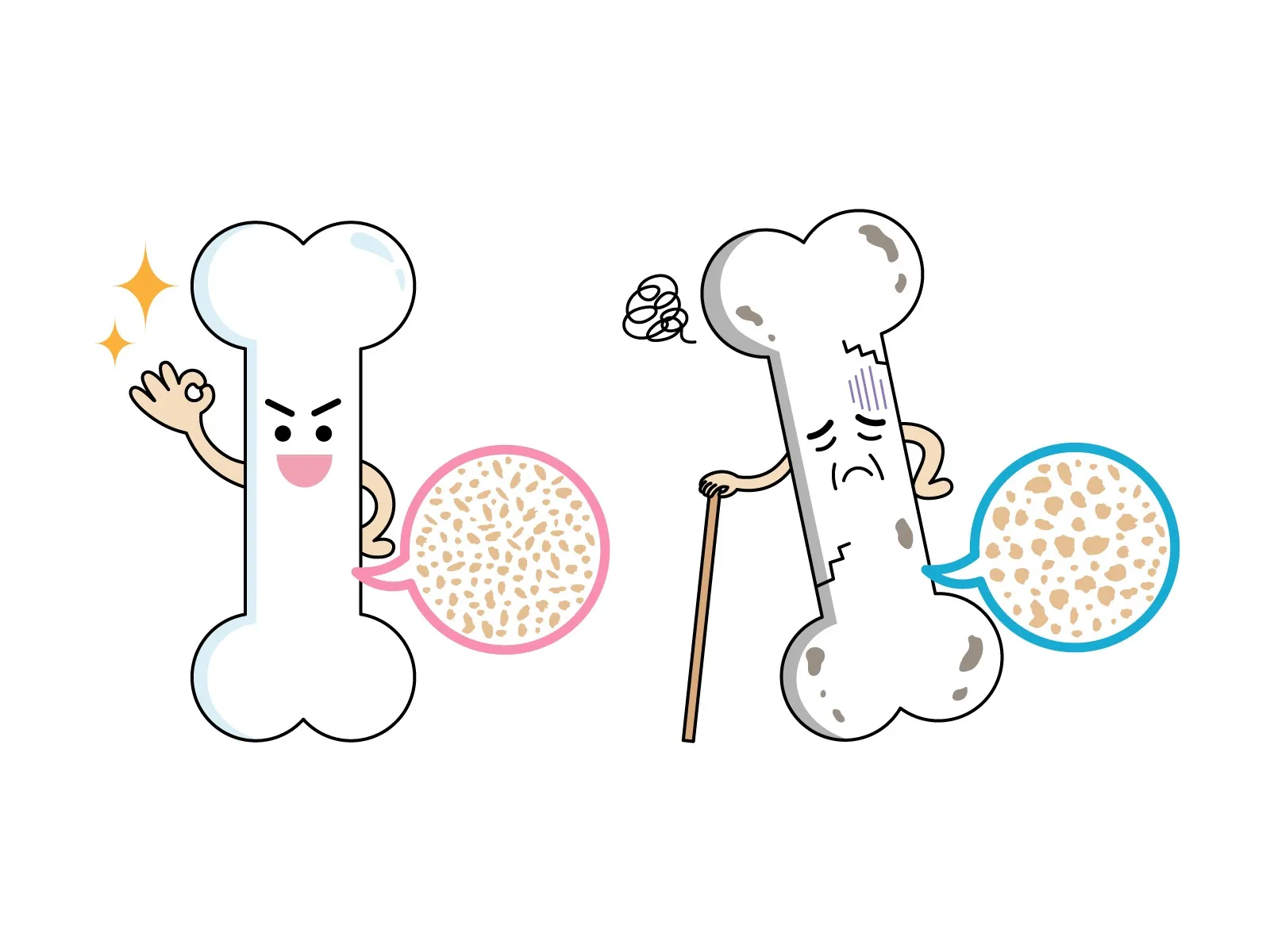 いつまでも自分の足で歩くために!「骨粗鬆症」の原因と今日からできる対策