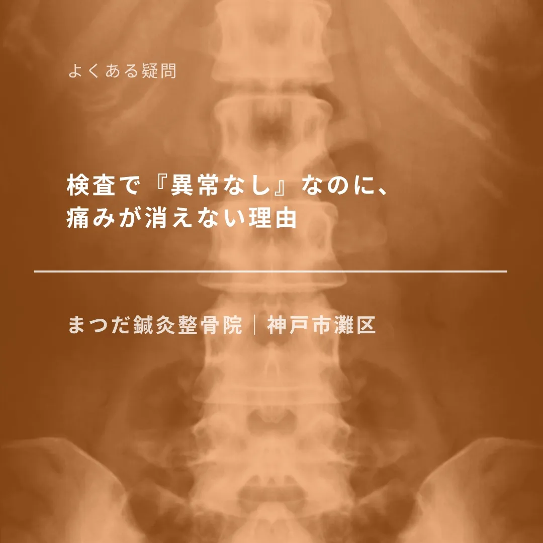 レントゲンやMRIを撮っても「異常なし」と言われたのに、痛み...
